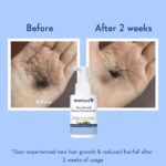 WishCare Hair Growth Serum Concentrate | Redensyl, Anagain & Rosemary | Boosts New Growth & Controls Hairfall | Hair Growth Serum for Scalp | In-Vivo Tested | For Men & Women | 30ml - Image 4