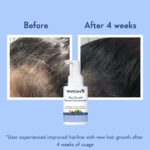WishCare Hair Growth Serum Concentrate | Redensyl, Anagain & Rosemary | Boosts New Growth & Controls Hairfall | Hair Growth Serum for Scalp | In-Vivo Tested | For Men & Women | 30ml - Image 5