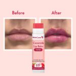 WishCare Tinted Lip Balm SPF 50 PA+++ | Brightening Lip Balm for Dark Lips | Kojic Acid & Niacinamide | For Women | 5g - Image 3