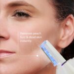 Michael Todd Beauty Sonicsmooth Pro+ Dermaplane Razor for Women Face + Eyebrow trimmer Dermaplaning System w/LED Light Peach Fuzz Remover -16 Dermaplaning Blades & 2 Microsmooth Exfoliation Tips - Image 4