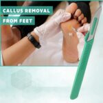 Disposable Sterile Razor Scalpel #23, Podiatry & Dermaplaning Tool, Precision Carbon-Steel Blades with Plastic Handle - Individual Pouches - Exfoliation, Dead Skin/Callus Removing & More - Box of 10 - Image 5