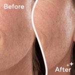 Finishing Touch Flawless Dermaplane Glo Sonic Lighted Facial Exfoliator, Electric Vibrating Dermaplane Razor for Dermaplaning, Facial Hair Removal, 6 Replacement Heads - Image 9